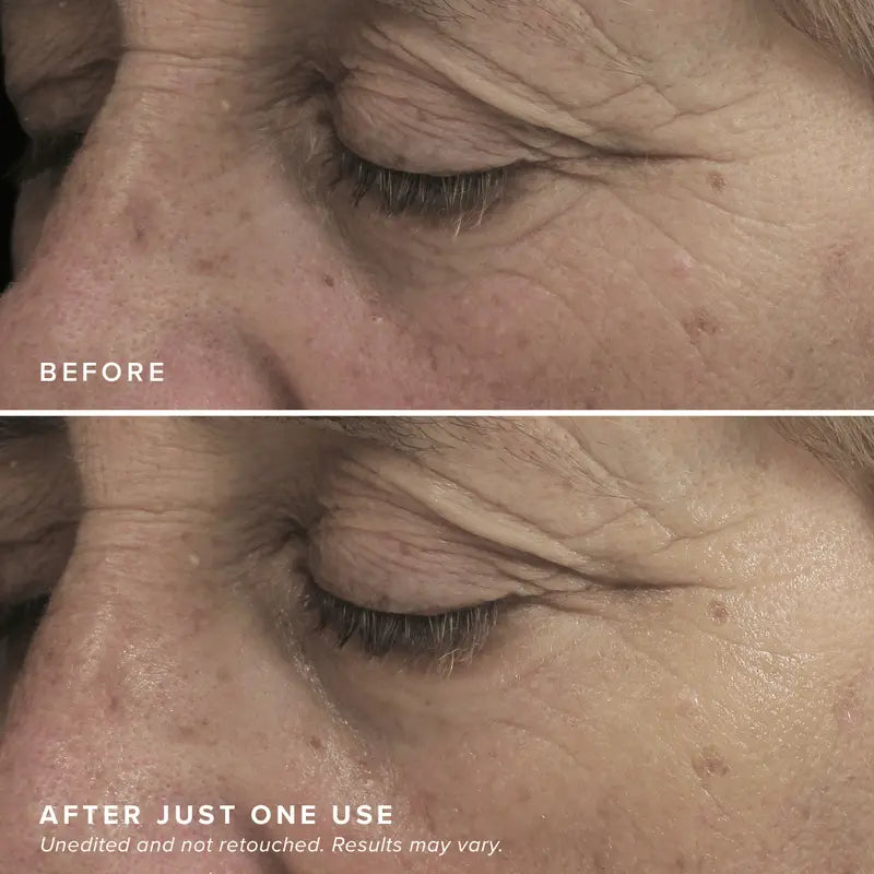 LOVILDS™ Brightening Eye Masks