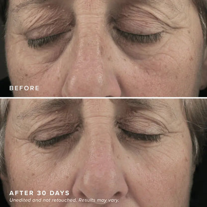 LOVILDS™ Brightening Eye Masks