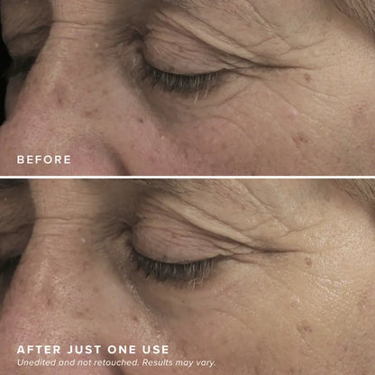 LOVILDS™ Brightening Eye Masks